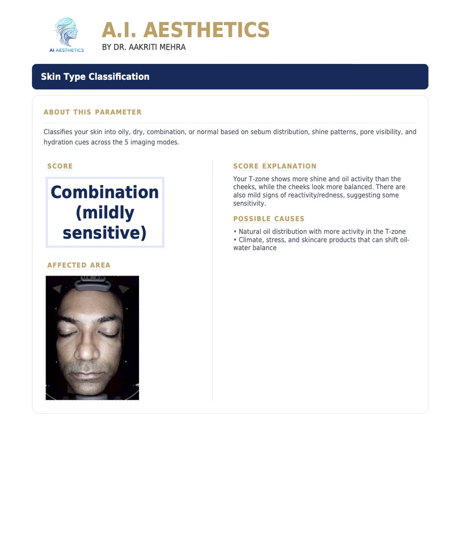 Sample AI Aesthetics skin analysis report — Skin Type Classification