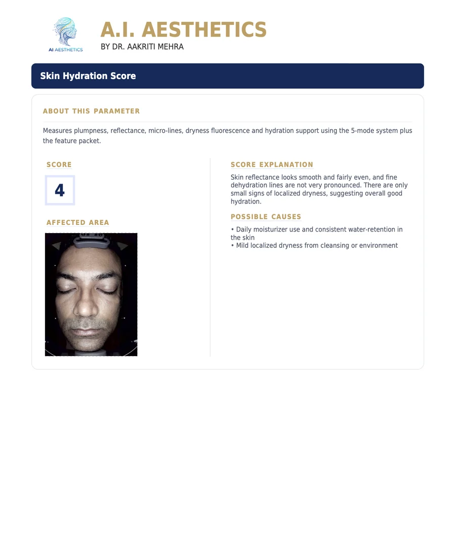 Sample AI Aesthetics skin analysis report — Skin Hydration