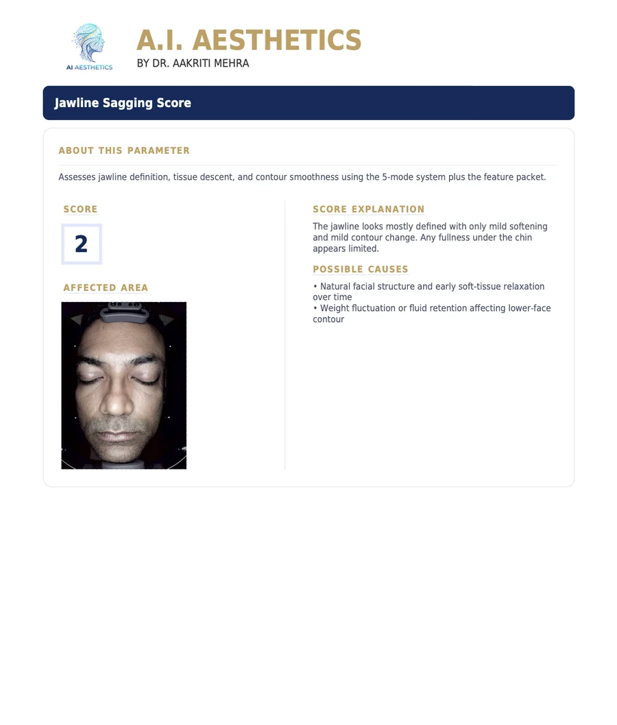 Sample AI Aesthetics skin analysis report — Jawline Sagging
