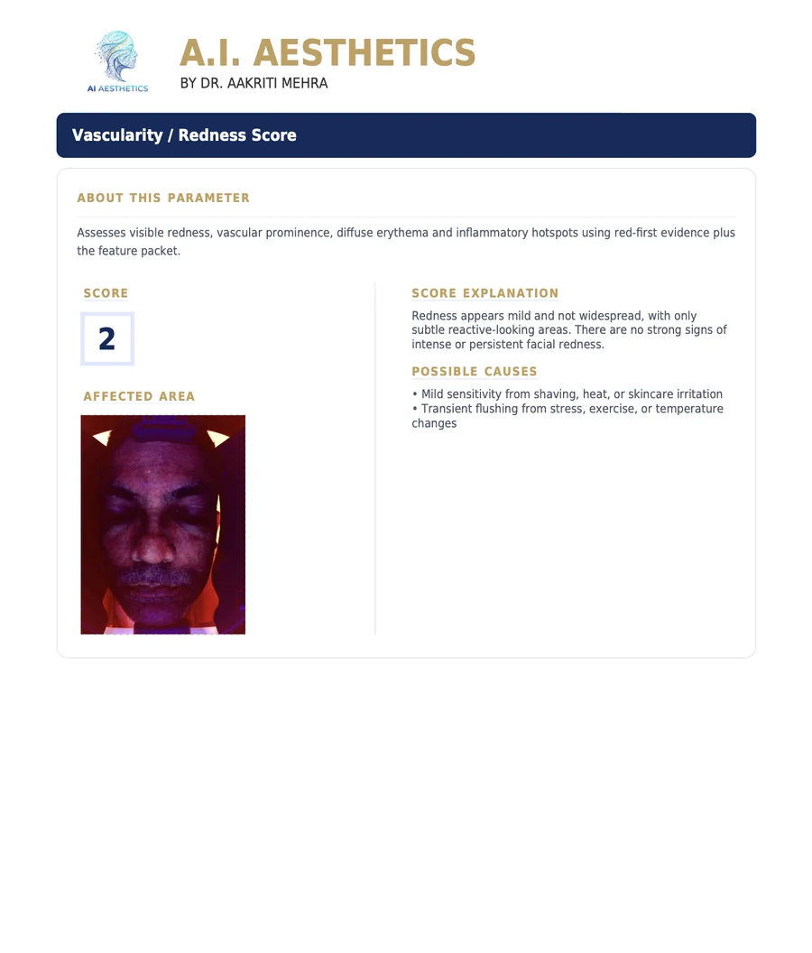 Sample AI Aesthetics skin analysis report — Vascularity Redness