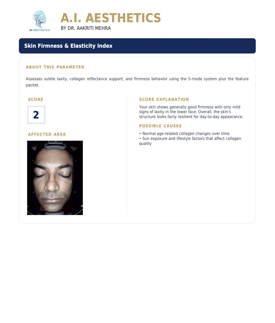 Sample AI Aesthetics skin analysis report — Skin Firmness