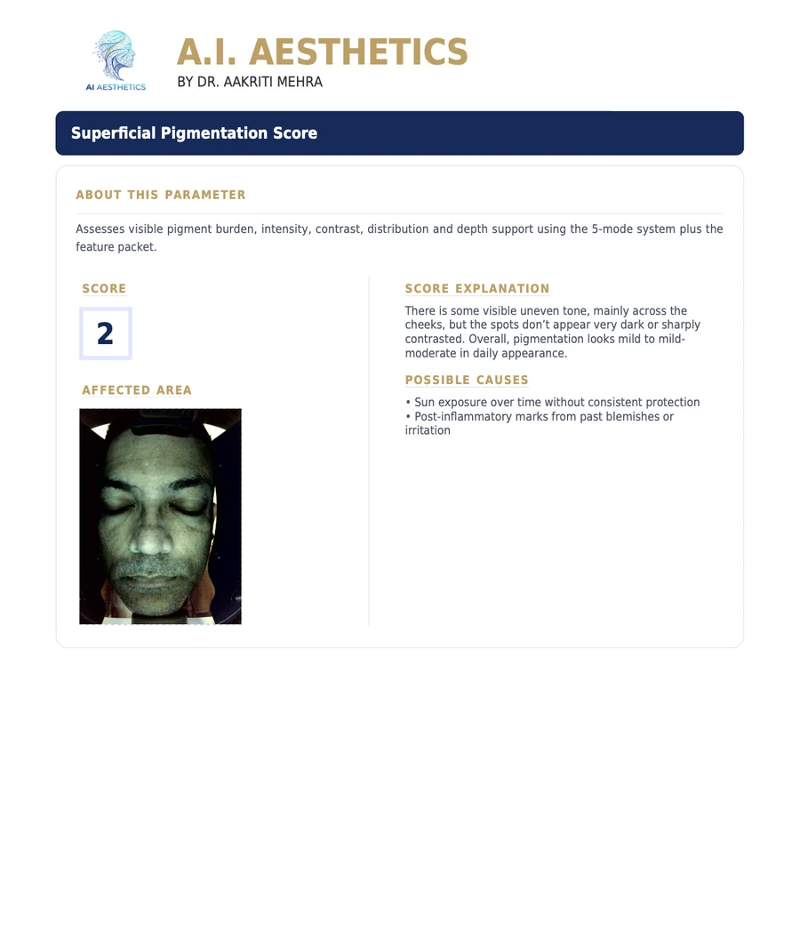 Sample AI Aesthetics skin analysis report — Superficial Pigmentation