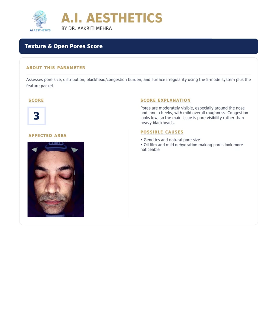 Sample AI Aesthetics skin analysis report — Texture Open Pores