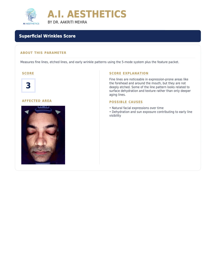 Sample AI Aesthetics skin analysis report — Superficial Wrinkles